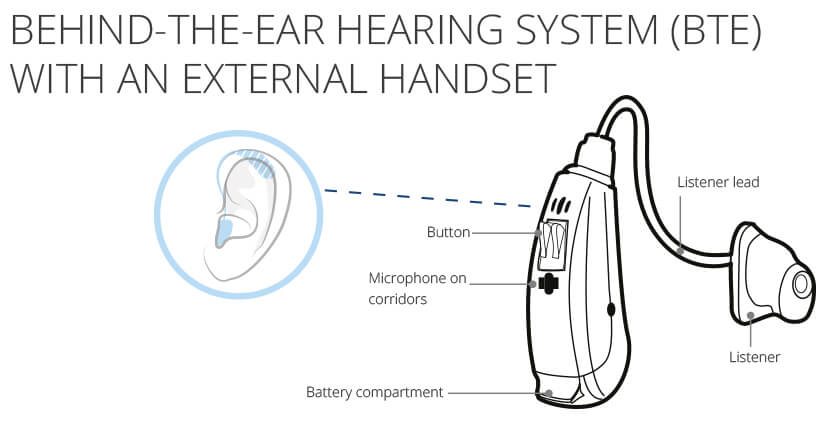BTE hearing machine (aid) components