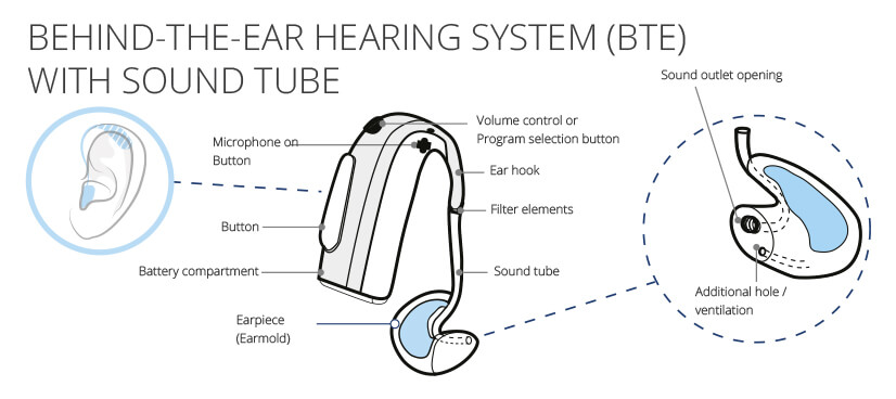 BTE hearing machine (aid) description