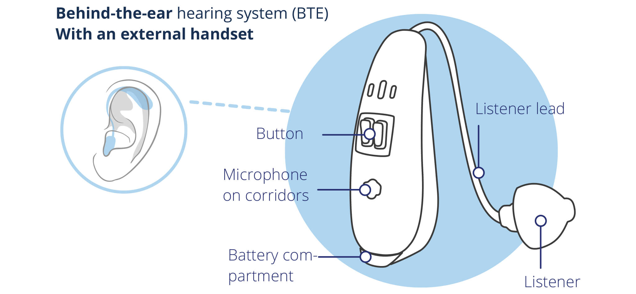 Behind The Ear Hearing Aids Bte Discreet And Modern Mys
